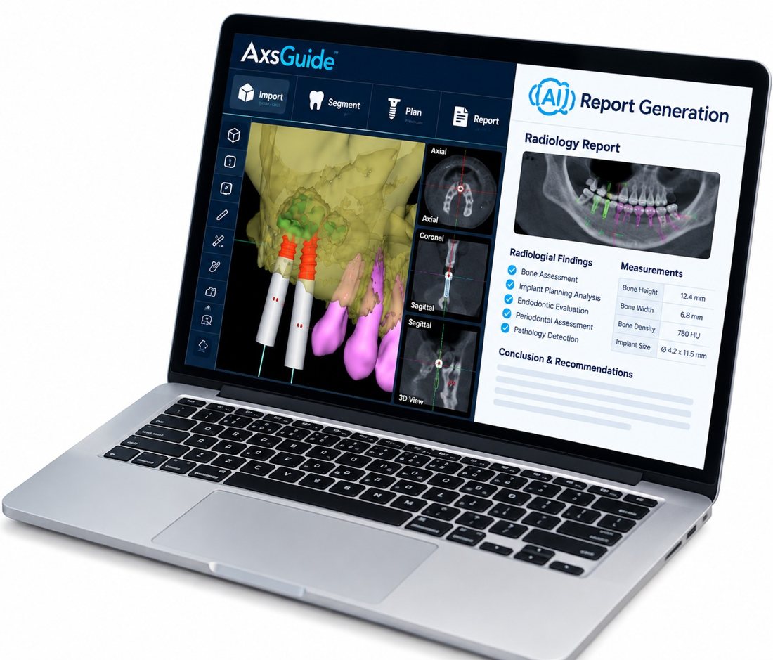 AxsGuide AI Report Generation: 3D implant planning and radiology report